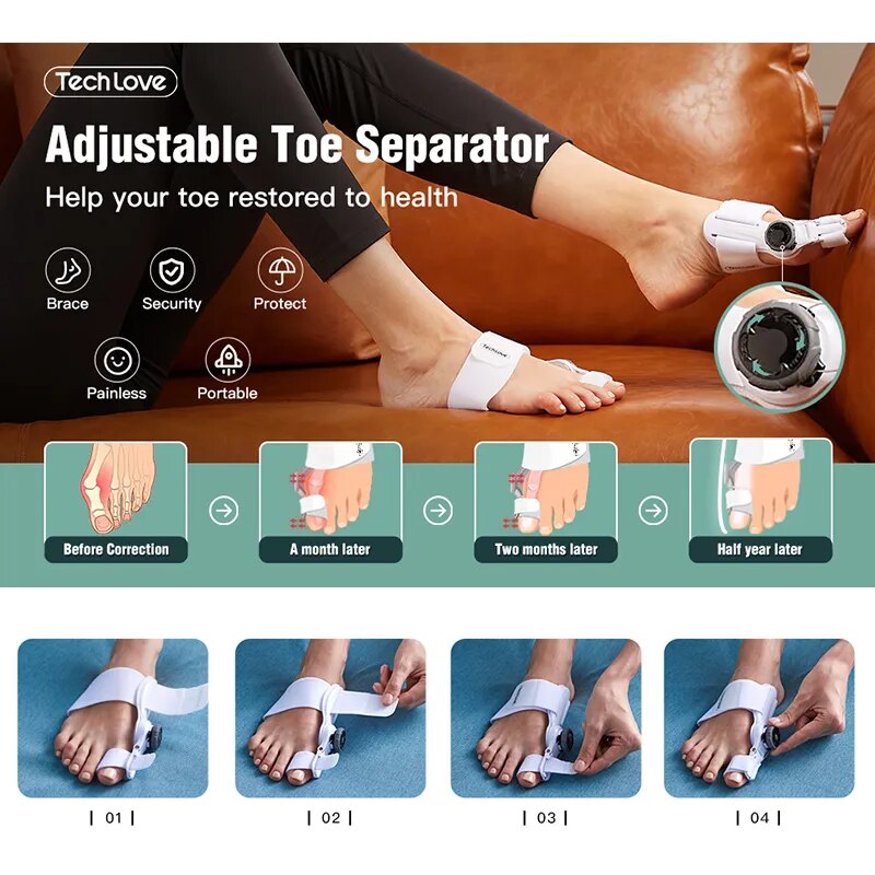 Orthopedic Bunion Corrector Hallux Valgus