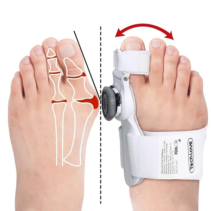 Orthopedic Bunion Corrector Hallux Valgus